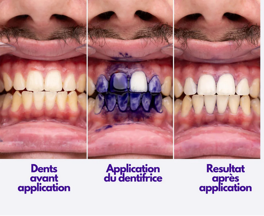 Dentifrice blanchissant